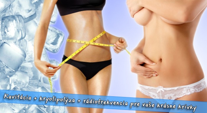Kryolipolýza, kavitácia, rádiofrekvencia - chudnite pod dohľadom profesionálov. Novinka vo svete skrášľujúcich ošetrení.