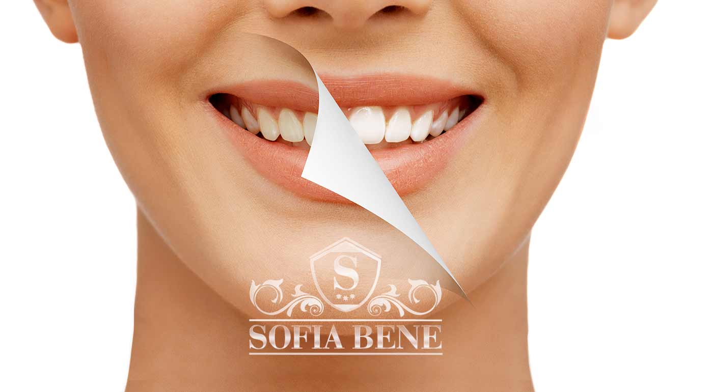 Laserové bielenie zubov