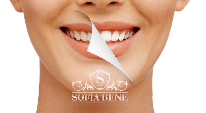 Laserové bielenie zubov