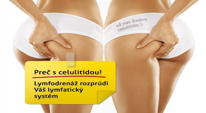 Pekný zadok, bruško, stehná? Lymfodrenáž to vyrieš