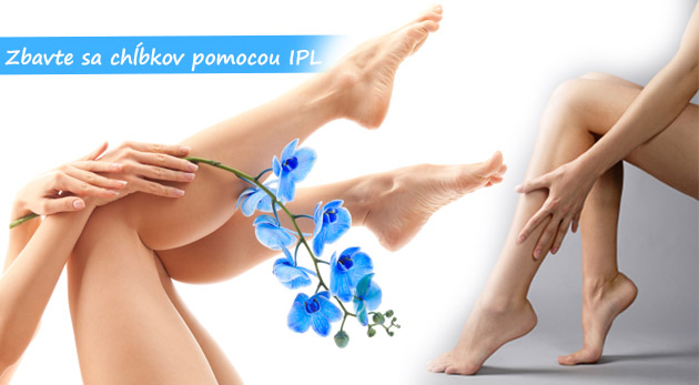 IPL epilácia - účinná metóda, s ktorou sa zbavíte 